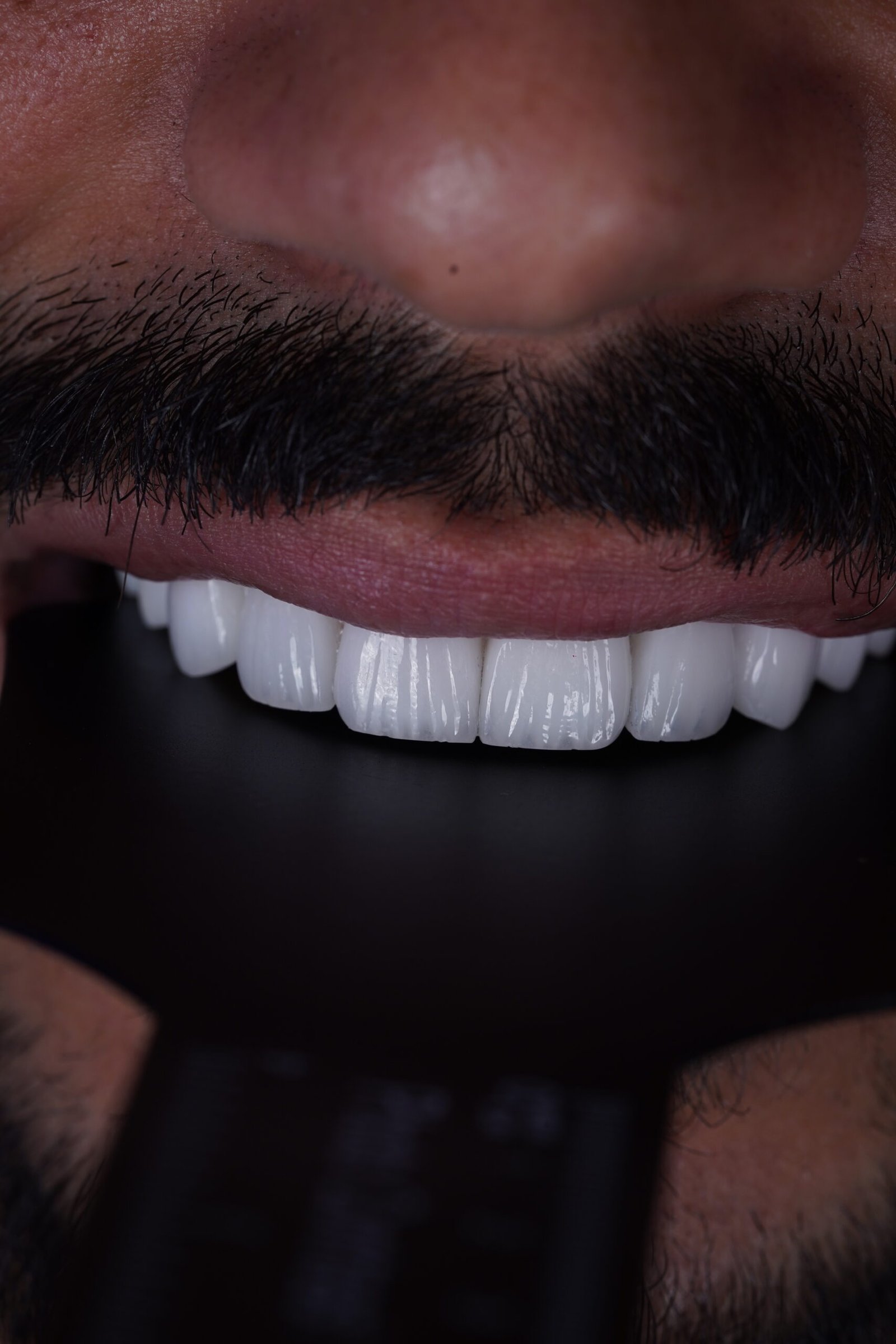 Technologie de pointe