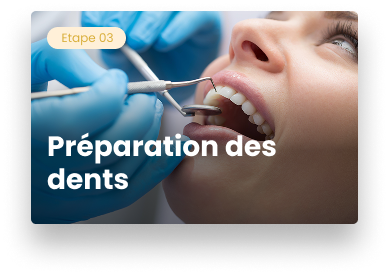 préparation des dents