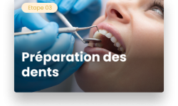 préparation des dents
